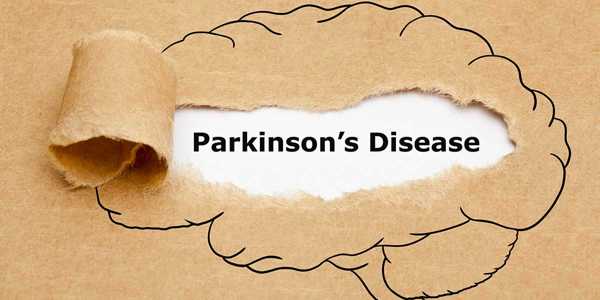 What are the 5 early signs of Parkinson's disease? 